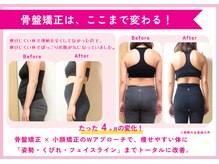理想の小顔