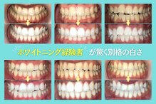 ノママホワイトニング 大宮店