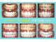 ノママホワイトニング 大宮店の写真