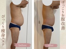 ラナ(LaNa)/ビール腹解消！！