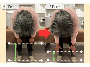 シェアハピネス たまプラーザ(share happiness)/Before＆After
