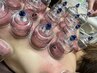 【はなはな】体のだるさ・慢性的な疲れ・血行促進に!カッピング60分6800円