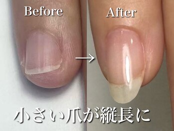 リリー/別人のような変化！