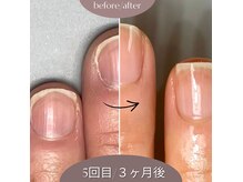 エイム(Aim)の雰囲気（人生まだまだこれから♪縦長爪は誰でもなれる♪）