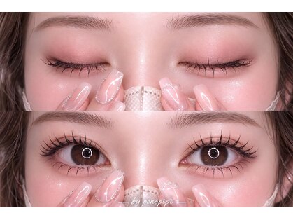 ポノピピ(ponopipi)の写真