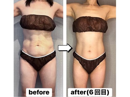 ブリス(bliss)の写真