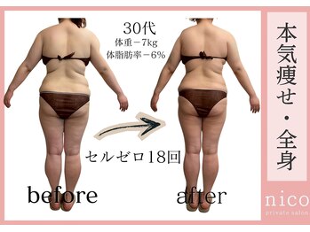 ニコ(nico)の写真/サイズダウンを目指すなら！全身痩せセルゼロで理想の私に♪ダイエット！