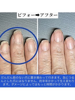 自爪育成は続ける事が成功のコツ