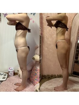 ポノ(Pono)/【痩身】サイドアングル