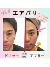 ドットエム(.m)/エアバリbefore・after