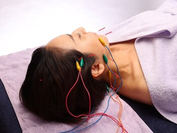 シー バイ カリスタ 新宿駅前店(C by CALISTA)/1/fリズムで心地よい電気美容鍼