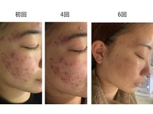 ユイット ルッカ(Huit Lucca)/アクアダーマ