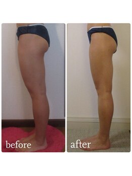 加圧ビューティーサロン スタイル エム(beauty salon style M)/20代/加圧×パワーツリー120分