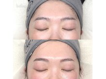 トリートマイセルフ(Treat myself)の雰囲気（フェイシャルWaxでツヤっとおでこ！（額の形のデザインも込み））