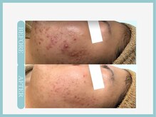 スリムライン 山形店(The Slim Line)/before→after