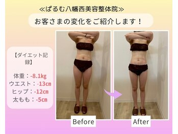 ぱるむ八幡西美容整体院/☆ダイエット☆