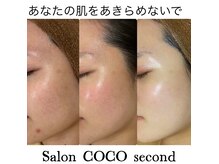 ココ 2号店(CoCo)