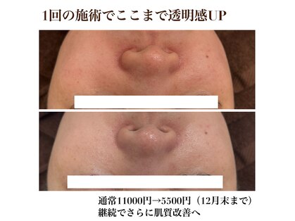 テンニック(10nick)の写真