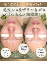 ソユ(SOYOU)/施術* &nbsp;&nbsp;&nbsp;ハーブピーリング