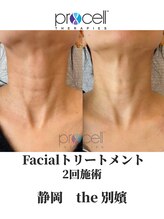 ザ ベッピン(the 別嬪)/首シワにも効果が期待できる！