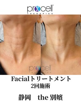 ザ ベッピン(the 別嬪)/首シワにも効果が期待できる！