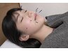【学生割引/中学生】美容はり施術