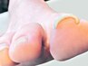 お悩み解消！巻爪カット