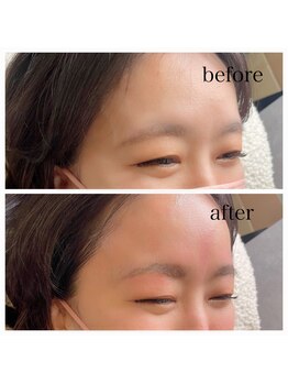 爪屋べっぴん堂/