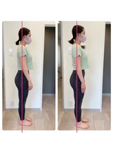 エーピラティス 美生体研究所(A pilates)/初回1回のみの姿勢変化(^^)