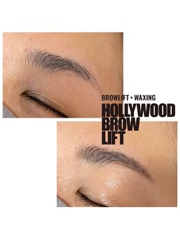 モル(Molu)/ハリウッドブロウリフト