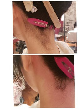 プトゥリ(Putri)/うなじワックス脱毛