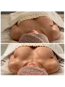 カナエルサロン 旭川(KANAERU SALON)/【バストアップ】症例☆