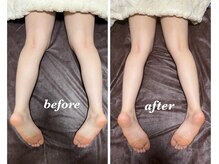 メル(MeRu)/足のむくみスッキリ！