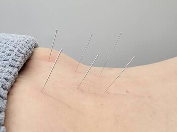 茶ノ木鍼灸整骨院の写真/「一般鍼灸」も「美容鍼灸」も当院で◎貴方の身体を丁寧にサポートします!初めての方にもオススメ!