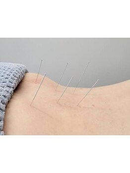 鍼灸施術を受けたい