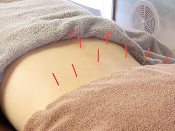 ハウオラ 三軒茶屋(HAUOLA)/施術【腰痛/骨盤矯正】