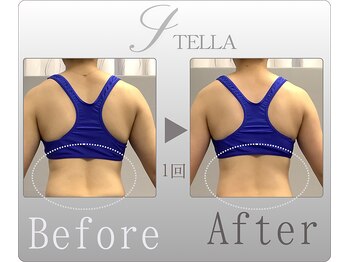 ステラ(STELLA)/上半身プレミアム１回の効果