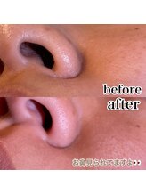 サロン ド ベル(salon de Belle)/お鼻ワックス