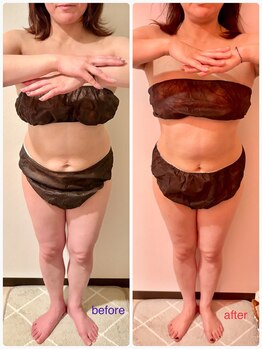 フーガ 宇都宮店(fu-ga)/やみつき 美骨リンパマッサージ