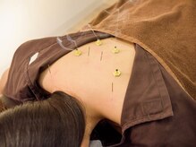 かわ鍼灸整体サロン/全身・自律神経調整≪鍼灸整体≫