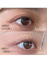 マツエク/LED/まつげパーマ/眉毛 /アンドヘルシー【Eye-Dentity 】福島/まつげケア/福島/まつげ美容液