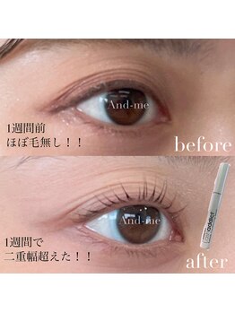 マツエク/LED/まつげパーマ/眉毛 /アンドヘルシー【Eye-Dentity 】福島/まつげケア/福島/まつげ美容液