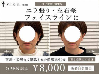 ヴィオン整体院(VION.整体院)の写真