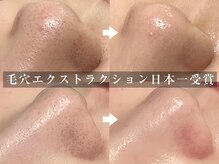 ティーティービューティー(TT Beauty)の雰囲気（毛穴エクストラクションコンテスト2日本一受賞[名古屋/栄/毛穴]）