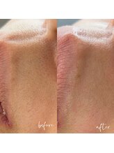 ノン(Non.)/ヌクレールフェイシャルワックス