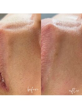 ノン(Non.)/ヌクレールフェイシャルワックス