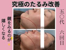 じぶんniプラスの雰囲気（本格レベルでお肌を生まれ変わるシワ　たるみ　くすみ　極上ケア）