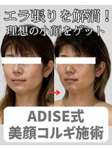 アディス 心斎橋(ADISE)/ADISE式コルギ！