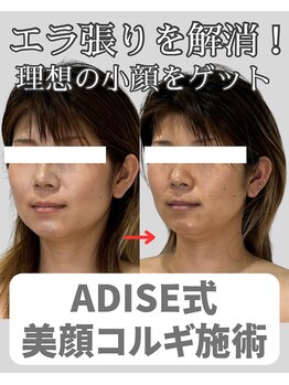 アディス 心斎橋(ADISE)/ADISE式コルギ！