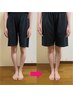 O脚、脚のむくみなど美脚になりたい方のコース22000→1980円【1日1名限定】